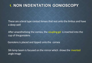1. NON INDENTATION GONIOSCOPY
These are scleral type contact lenses that rest onto the limbus and have
a deep well
After anaesthetising the cornea,the couplinggel is inserted into the
cup of thegoniolens
Goniolensis placed and tipped ontothe cornea
Slit-lamp beam is focused on the mirrorwhich showsthe inverted
angleimage
 
