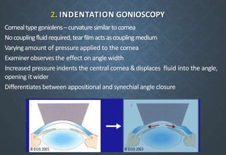 2. INDENTATION GONIOSCOPY
Cornealtypegoniolens–curvaturesimilartocornea
Nocouplingfluidrequired,tearfilmactsascouplingmedium
Varyingamount of pressure applied to the cornea
Examinerobservesthe effect on angle width
Increased pressure indents the central cornea &displaces fluid into the angle,
opening itwider
Differentiates between appositional and synechial angle closure
 