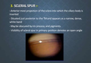 3. SCLERAL SPUR :-
-Anterior most projection of thesclera into which the ciliary body is
inserted
- Situated just posterior to the TMand appears as a narrow, dense,
white band
-Maybe obscured byiris process,and pigments.
- Visibility of scleral spur in primary position denotes an open angle
 