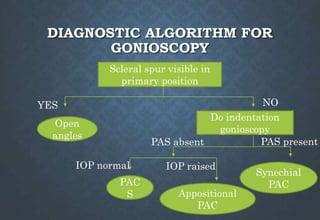DIAGNOSTIC ALGORITHM FOR
GONIOSCOPY
Scleral spur visible in
primary position
Open
angles
YES NO
Do indentation
gonioscopy
PAS present
PAS absent
Synechial
PAC
PAC
S
IOP normal IOP raised
Appositional
PAC
 