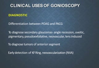 CLINICAL USES OF GONIOSCOPY
DIAGNOSTIC
Differentiation between POAG and PACG
To diagnosesecondary glaucomas-anglerecession,uveitic,
pigmentary,pseudoexfoliative,neovascular,lens induced
Todiagnose tumors of anterior segment
Earlydetection of KFRing,neovascularization (NVA)
 