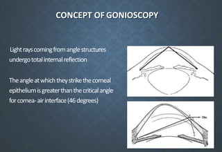 CONCEPT OF GONIOSCOPY
Lightrayscomingfromanglestructures
undergototalinternalreflection
Theangleatwhichtheystrikethecorneal
epitheliumisgreaterthanthecriticalangle
forcornea-airinterface(46degrees)
 