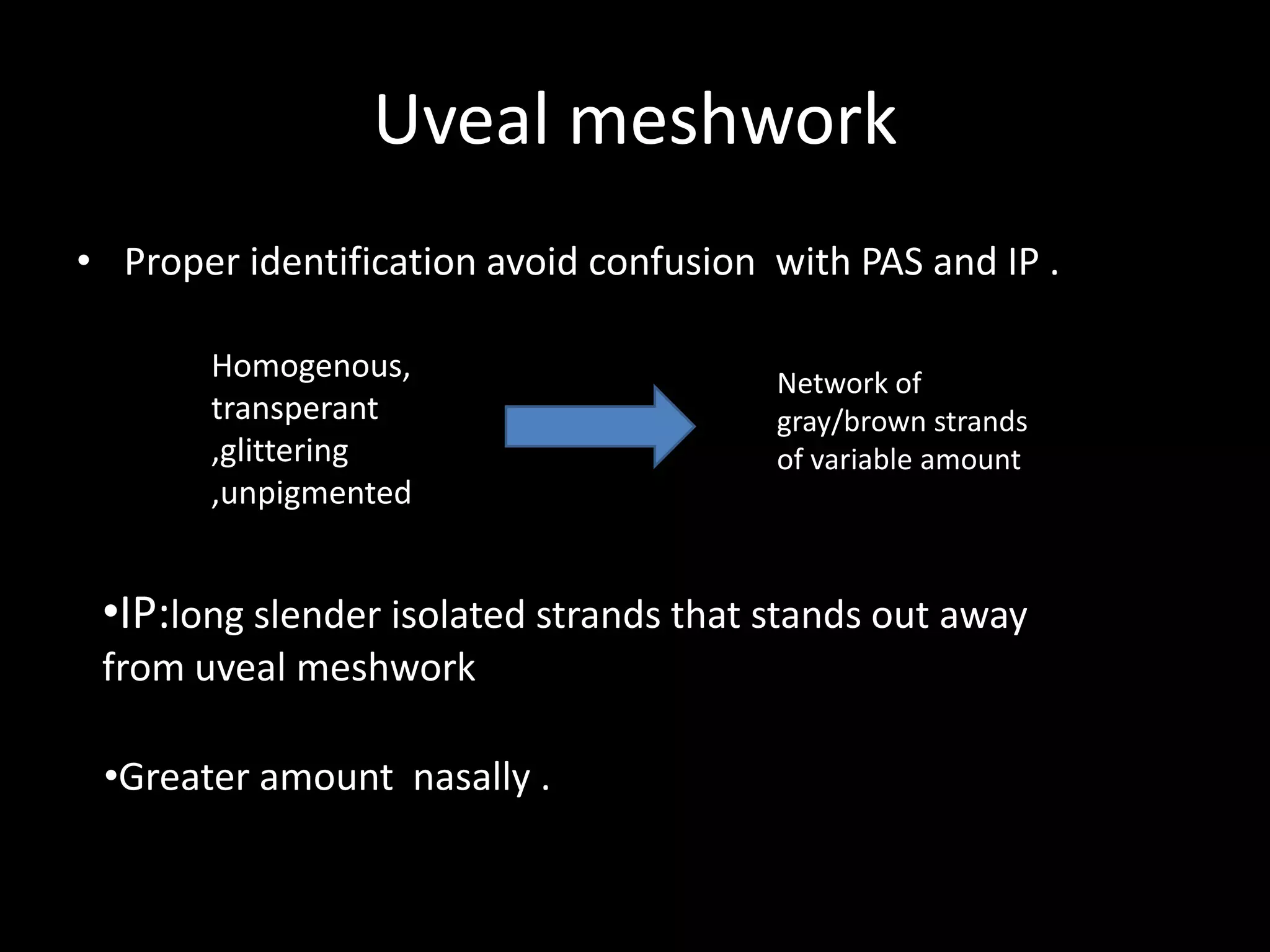 Uveal meshwork
• Proper identification avoid confusion with PAS and IP .

       Homogenous,                      Network of
       transperant                      gray/brown strands
       ,glittering                      of variable amount
       ,unpigmented


 •IP:long slender isolated strands that stands out away
 from uveal meshwork

 •Greater amount nasally .
 