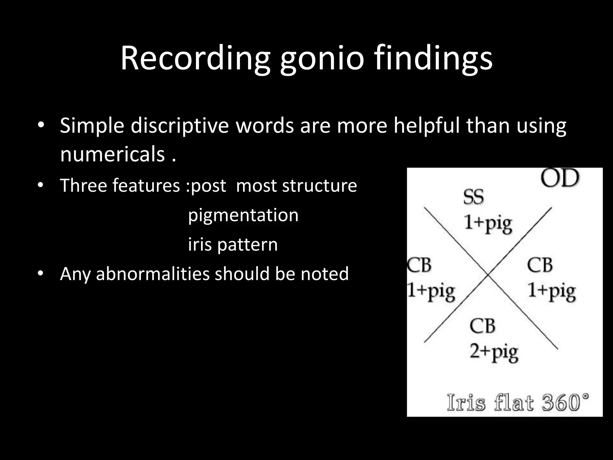 Recording gonio findings
• Simple discriptive words are more helpful than using
  numericals .
• Three features :post most structure
                 pigmentation
                 iris pattern
• Any abnormalities should be noted
 