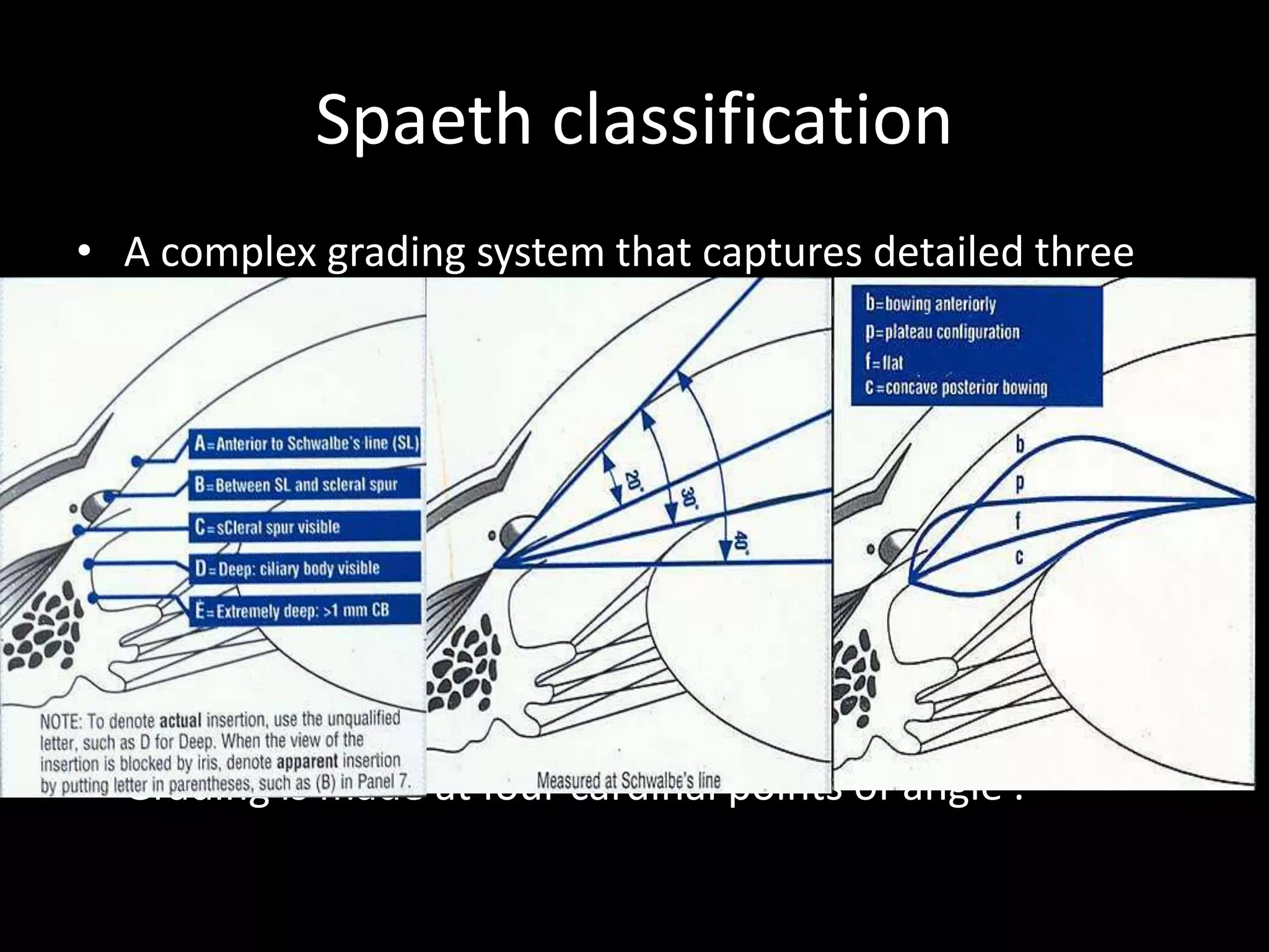Spaeth classification
• A complex grading system that captures detailed three
  dimensional information in coded form .
• High correlation with UBM and biometric gonioscopy.
• Interobserver variability - minimal .
• Addresses : 1.site of iris insertion .
              2.angle width.
              3.config of peripheral iris.
              4.trabecular meshwork pigmentation.
              5.presence/absence of abnormalities.
• Grading is made at four cardinal points of angle .
 