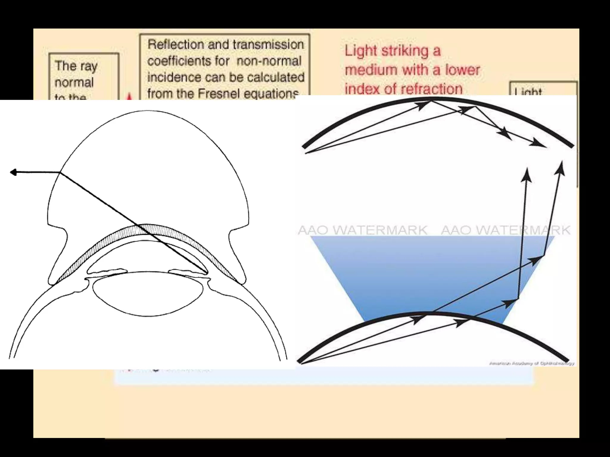 principle
•   Critical angle .
•   Total internal reflection .
•   Eliminates corneal-air interface
•   Direct and indirect gonioscopy
 
