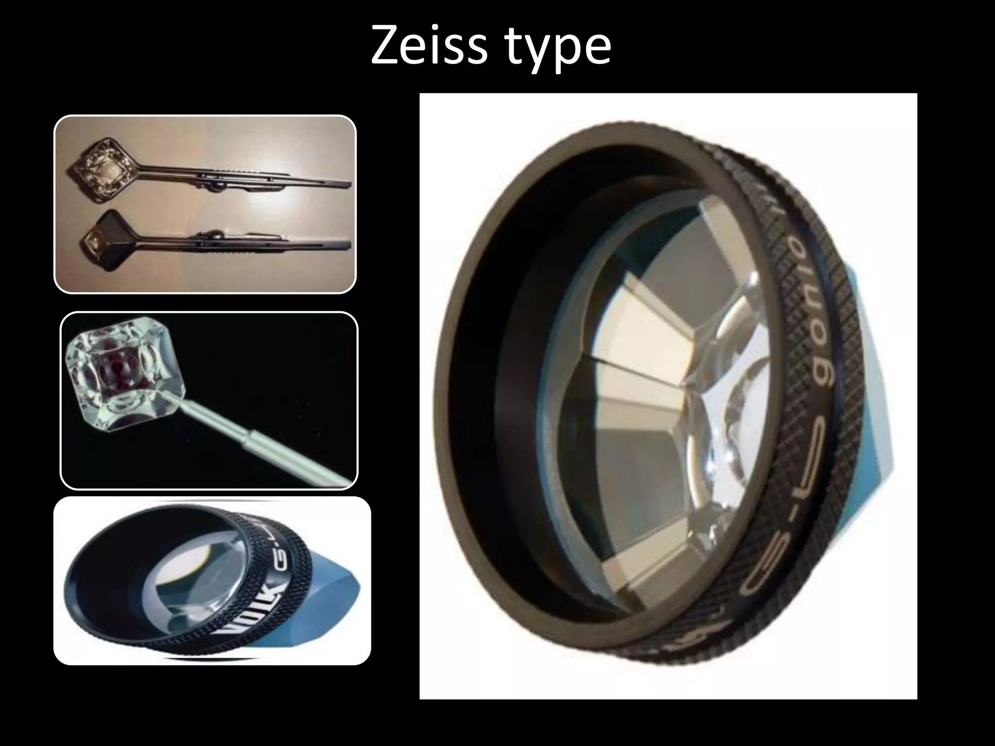 Zeiss type
      Zeiss four mirror
      • Mirror:64
      • Require unger/holder



      Posner four mirror
      • Modified zeiss with
        attached handle


       Sussman four mirror
       • Handheld zeiss type
         gonioprism
 