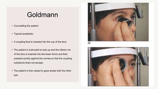 Goldmann
• Counselling the patient.
• Topical anesthetic.
• A coupling fluid is inserted into the cup of the lens.
• The patient is instructed to look up and the inferior rim
of the lens is inserted into the lower fornix and then
pressed quickly against the cornea so that the coupling
substance does not escape.
• The patient is then asked to gaze ahead with the other
eye.
 