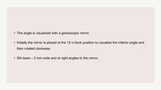 • The angle is visualized with a gonioscopic mirror.
• Initially the mirror is placed at the 12 o’clock position to visualize the inferior angle and
then rotated clockwise.
• Slit beam - 2 mm wide and at right angles to the mirror.
 