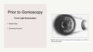 Torch Light Examination
Prior to Gonioscopy
• Eclipse Sign.
• Screening Purpose.
 