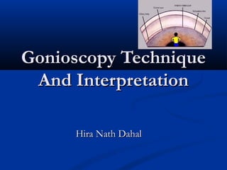 Gonioscopy TechniqueGonioscopy Technique
And InterpretationAnd Interpretation
Hira Nath DahalHira Nath Dahal
 