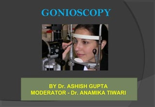 GONIOSCOPY
BY Dr. ASHISH GUPTA
MODERATOR - Dr. ANAMIKA TIWARI
 