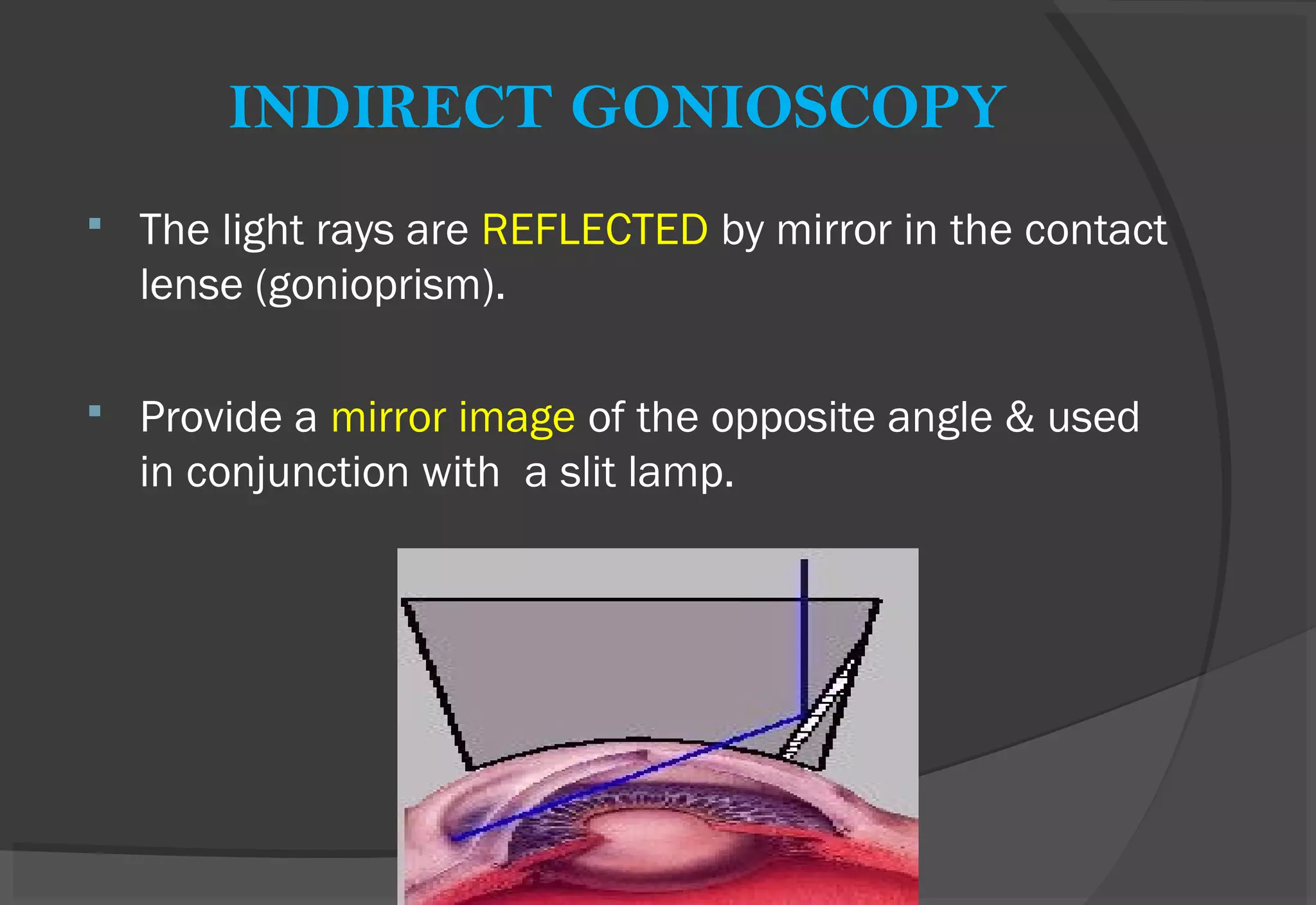 INDIRECT GONIOSCOPY
 The light rays are REFLECTED by mirror in the contact
lense (gonioprism).
 Provide a mirror image of the opposite angle & used
in conjunction with a slit lamp.
 
