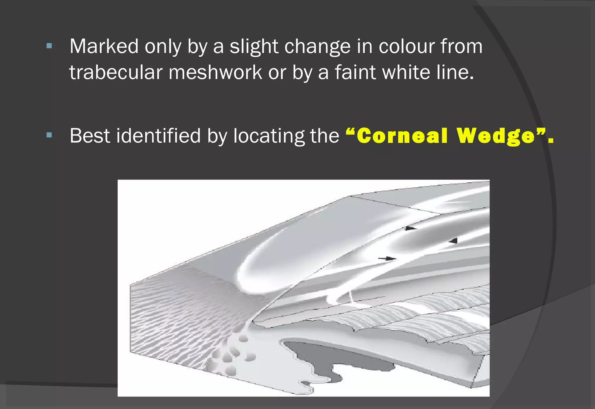 Marked only by a slight change in colour from
trabecular meshwork or by a faint white line.
 Best identified by locating the “Corneal Wedge”.
 