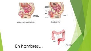 Abscesos prostáticos Epididimitis 
En hombres… Proctitis 
 