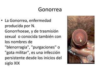 Gonorrea
• La Gonorrea, enfermedad
  producida por N.
  Gonorrhoeae, y de trasmisión
  sexual o conocida también con
  los nombres de
  "blenorragia", "purgaciones" o
  "gota militar", es una infección
  persistente desde los inicios del
  siglo XIX
 