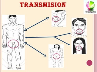 FORMAS DE TRANSMISION 