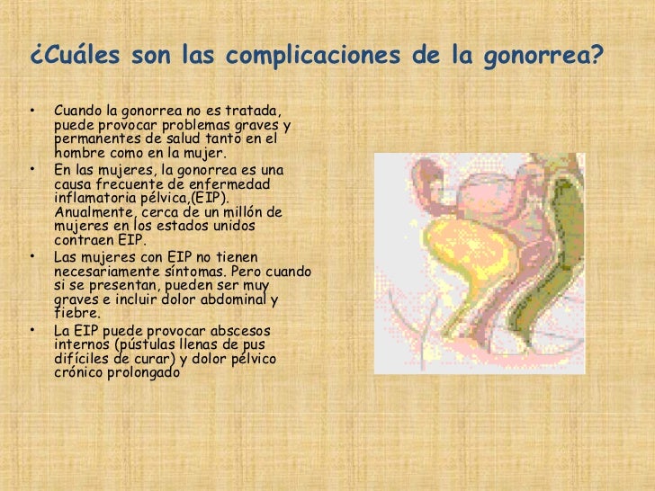 Que tal kresttsovyy la osteocondrosis