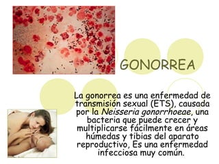 GONORREA
La gonorrea es una enfermedad de
transmisión sexual (ETS), causada
por la Neisseria gonorrhoeae, una
bacteria que puede crecer y
multiplicarse fácilmente en áreas
húmedas y tibias del aparato
reproductivo, Es una enfermedad
infecciosa muy común.
 