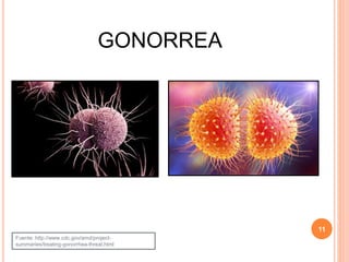 GONORREA
11
Fuente: http://www.cdc.gov/amd/project-
summaries/treating-gonorrhea-threat.html
 