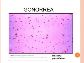 GONORREA
12Fuente: Antibiotic resistance in gonorrhea/
https://en.wikipedia.org/wiki/Antibiotic_resistance_in_gonorrhea
Neisseria
gonorrhoeae
 
