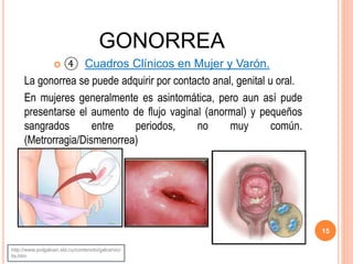 GONORREA
 ④ Cuadros Clínicos en Mujer y Varón.
La gonorrea se puede adquirir por contacto anal, genital u oral.
En mujeres generalmente es asintomática, pero aun así pude
presentarse el aumento de flujo vaginal (anormal) y pequeños
sangrados entre periodos, no muy común.
(Metrorragia/Dismenorrea)
15
http://www.polgalvan.sld.cu/contenido/galcervici
tis.htm
 