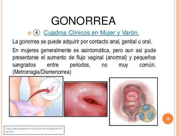 Anal a la de cabello largo 4