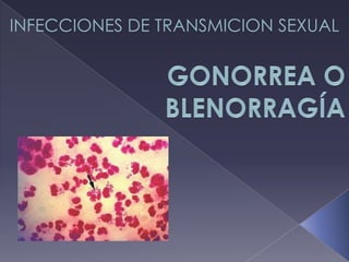 INFECCIONES DE TRANSMICION SEXUAL
 