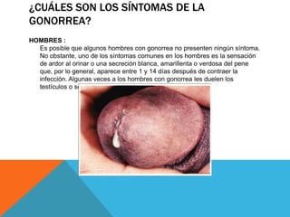 ¿CUÁLES SON LOS SÍNTOMAS DE LA
GONORREA?
HOMBRES :
Es posible que algunos hombres con gonorrea no presenten ningún síntoma.
No obstante, uno de los síntomas comunes en los hombres es la sensación
de ardor al orinar o una secreción blanca, amarillenta o verdosa del pene
que, por lo general, aparece entre 1 y 14 días después de contraer la
infección. Algunas veces a los hombres con gonorrea les duelen los
testículos o se les inflaman.
 