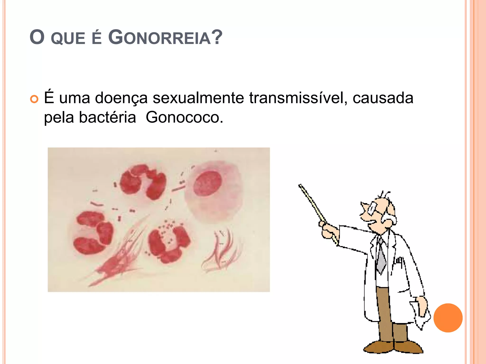 gonorreia-pptx