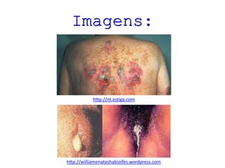 Imagens:
http://williamenatashabioifes.wordpress.com
http://nt.estiga.com
 