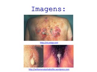 Imagens:

http://nt.estiga.com

http://williamenatashabioifes.wordpress.com

 