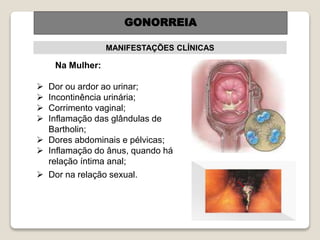 Na Mulher:
 Dor ou ardor ao urinar;
 Incontinência urinária;
 Corrimento vaginal;
 Inflamação das glândulas de
Bartholin;
 Dores abdominais e pélvicas;
 Inflamação do ânus, quando há
relação íntima anal;
 Dor na relação sexual.
GONORREIA
MANIFESTAÇÕES CLÍNICAS
GONORREIA
 