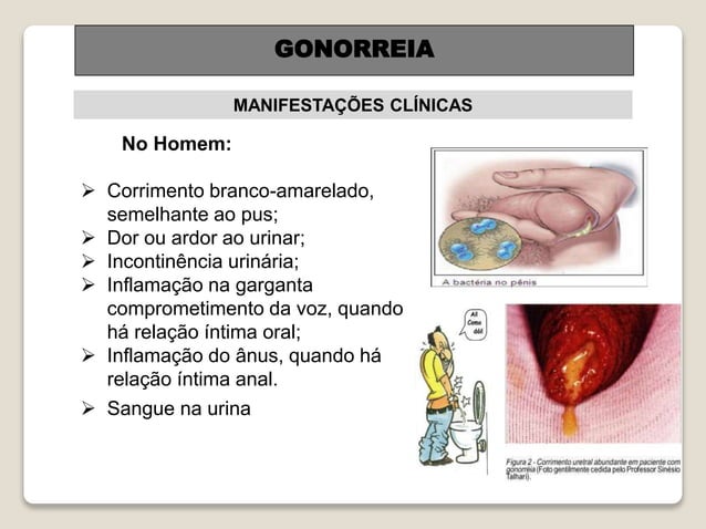 gonorreia-pptx