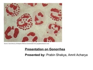 Source: Gonorrhea by Christopher Michaud (downloaded from googlebooksearch.com)




                                    Presentation on Gonorrhea
                                    Presented by: Prabin Shakya, Amrit Acharya
 