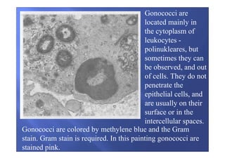 Gonococci are
located mainly in
the cytoplasm of
leukocytes -
polinukleares, but
sometimes they can
be observed, and out
of cells. They do not
penetrate the
epithelial cells, and
are usually on their
surface or in the
intercellular spaces.
Gonococci are colored by methylene blue and the Gram
stain. Gram stain is required. In this painting gonococci are
stained pink.
 