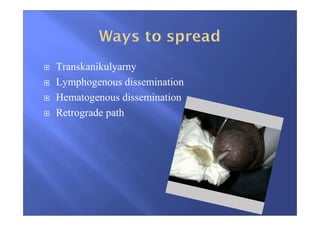 Transkanikulyarny
Lymphogenous dissemination
Hematogenous dissemination
Retrograde path
 