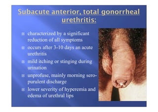 characterized by a significant
reduction of all symptoms
occurs after 3-10 days an acute
urethritis
mild itching or stinging during
urination
unprofuse, mainly morning sero-
purulent discharge
lower severity of hyperemia and
edema of urethral lips
 