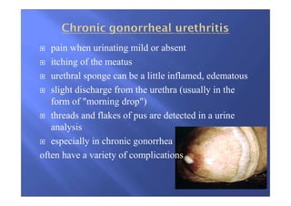pain when urinating mild or absent
itching of the meatus
urethral sponge can be a little inflamed, edematous
slight discharge from the urethra (usually in the
form of "morning drop")
threads and flakes of pus are detected in a urine
analysis
especially in chronic gonorrhea
often have a variety of complications
 