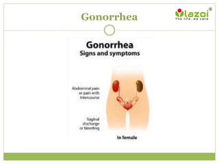 Gonorrhea
 