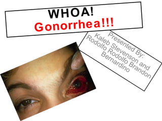 Presented By: Kaleb Stevenson and Rodolfo Rodolfo Brandon Bernardino WHOA!  Gonorrhea!!! 
