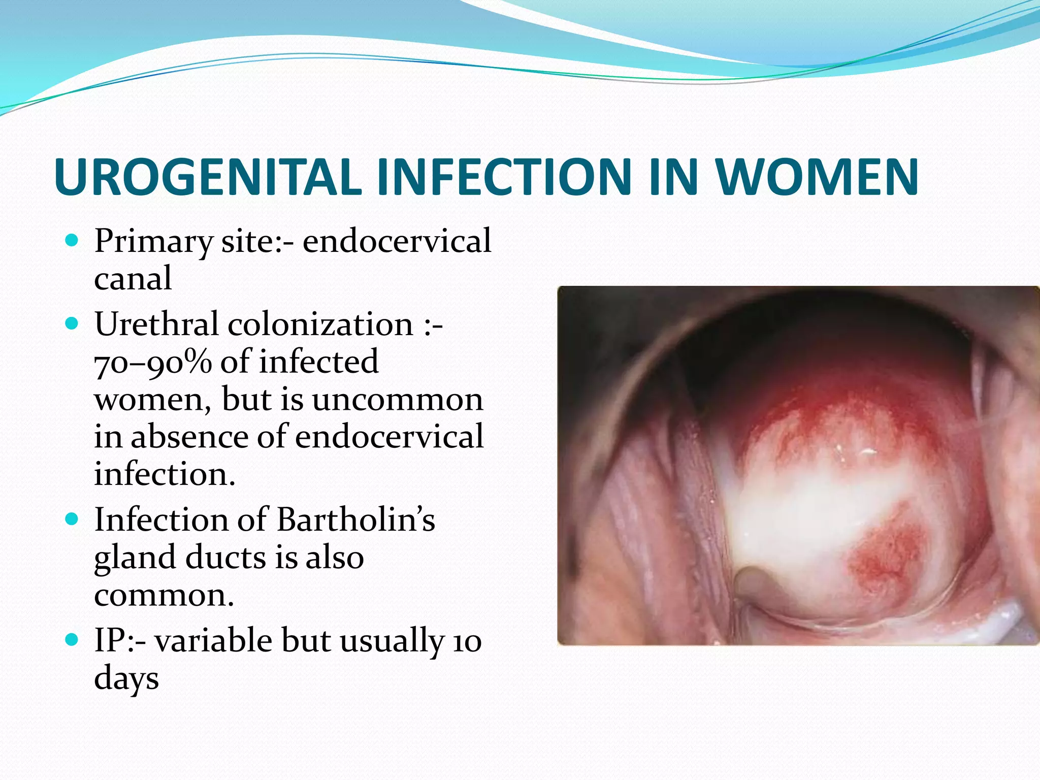 Obsense Infection Gonorrhoea | PPTX