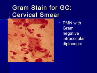 Gram Stain for GC:
Cervical Smear


PMN with
Gram
negative
intracellular
diplococci

 
