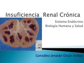 Sistema Endócrino
Biología Humana y Salud
González Jonatán Oscar Aníbal
Wikipedia
http://upload.wikimedia.org/wikipedia/commons/8/82/Kidney_%E2%
80%93_acute_cortical_necrosis.jpg
 