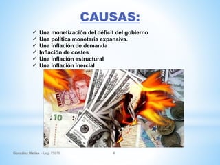 González Matías - Leg. 75976 4
 Una monetización del déficit del gobierno
 Una política monetaria expansiva.
 Una inflación de demanda
 Inflación de costes
 Una inflación estructural
 Una inflación inercial
 