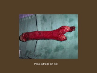 Pene extraído sin piel