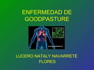 ENFERMEDAD DE
GOODPASTURE

LUCERO NATALY NAVARRETE
FLORES

 