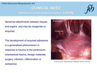 Fidia Advanced Biopolymers Srl
CLINICAL NEED
Adhesions in the abdomino-pelvic cavity
Courtesy from: International Adhesion Society web site
Abnormal attachments between tissues
and organs and may be congenital or
acquired.
The development of acquired adhesions
is a generalised phenomenon in
response to trauma to the peritoneum
(mechanical trauma, foreign materials,
surgery, infection, inflammation or
ischaemia)
 