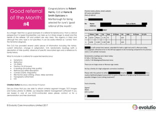 © Evolutio Care Innovations Limited 2017
Congratulations	to	Robert	
Harris,	CLO	at	Haine	&	
Smith	Opticians	in	
Marlborough	for	being	
selected	for	June’s	‘good	
referral	of	the	month’.	
As a triager I feel this is a good example of a referral for keratoconus. From a clerical
perspective it is typed (handwritten can take up to 6 times longer to read) and the
details of the referrer, GP and patient are very clear. The urgency is clear and
although the clinic type is not specified, it can be easily inferred as ‘cornea’ from
the tentative diagnosis.
The CLO has provided several useful pieces of information including the history,
current refraction, change in astigmatism, V/A, keratometry readings (with a
description of mire quality), absence of specific associated signs and a reference to
family history.
What to include in a referral for suspected keratoconus:
• Symptoms
• Refraction
• VA (D&N)
• Previous VA (if known)
• K readings (including mire quality)
• Retinoscopy reflex description
• Cornea (clarity, irregularity)
• Risk factors (eye rubbing, atopy, sleep apnoea)
• Topography (attached)
• F/H
Christian Dutton BSc(Hons.) MScClinOpt FCOptom
Did you know that you are able to attach anterior segment images, OCT images
and fundus photos to eRefer, our bespoke referral management software? If you
are based in one of our CCG-contracted areas please contact us for a
demonstration and free download.
Practice	name,	phone,	email,	website	
GP	name	and	address	
Date	of	referral	
	
Dear	General	Practitioner,	
	
Re:	 Name:		 XXXXXX	XXXXXX	 	 	 Date	of	Birth:	 	 XXXXXX	
	 Address:	 XXXXXX	XXXXXX	XXXXXX	XXXXXX	XXXXXX	XXXXXX	XXXXXX	XXXXXX	
	
Most	Recent	RX:	XXXXXX/2017	
	
	 Vision	 Sph	 Cyl	 Axis	 D	Prism	 VA	 Add	 N	Prism	 N	V/A	
R	 6/15+	 Plano	 -1.75	 75	 	 	 6/6	 	 	
	 	
L	 6/38	 +3.00	 -5.50	 100	 	 	 6/6-	 	 	
	 	
	
XXXXXX,	a	soft	contact	lens	wearer,	attended	for	both	a	sight	test	and	CL	aftercare	today.	
His	astigmatic	refractive	error	in	the	left	eye	appears	to	be	increasing	compared	to	his	previous	
visits	(-1.25	cylinder	increase).	
	
Keratometry	readings	were	taken	today:	
R	7.85	x	7.95	Clear	mires	
L	8.20	x	7.45	Malaligned/Distorted	mires	
	
There	are	no	Vogts	straie	or	Munson	sign	noted.	
	
He	has	a	family	of	a	high	astigmatic	correction	(mother).	
	
Please	refer	this	patient	to	either	XXXXXX	XXXXXX	Hospital	XXXXXX	or	XXXXXX	XXXXXX	for	a	
routine	Ophthalmological	assessment	to	query	a	diagnosis	of	progressing	Kerataconous	and	
possible	Collagen	Cross	Linking	treatment?	
	
	
Yours	sincerely,	
	
Signed	
Name	
GOC	number	
	
CC:	XXXXXX	XXXXXX	
	
Good referral
of the Month:
#4
 