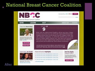 National Breast Cancer Coalition After 